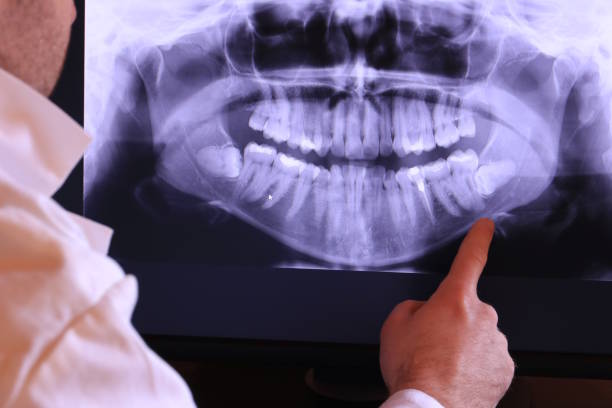 Best Broken Tooth Emergency  in Winnfield, LA