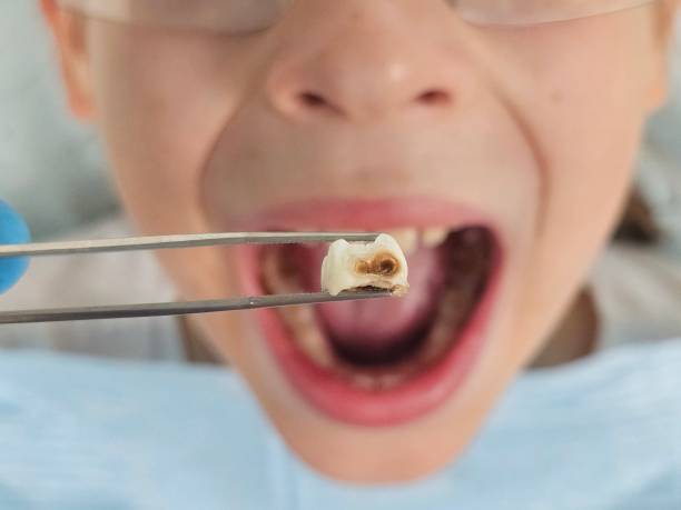 Best Urgent Dental Care  in Winnfield, LA